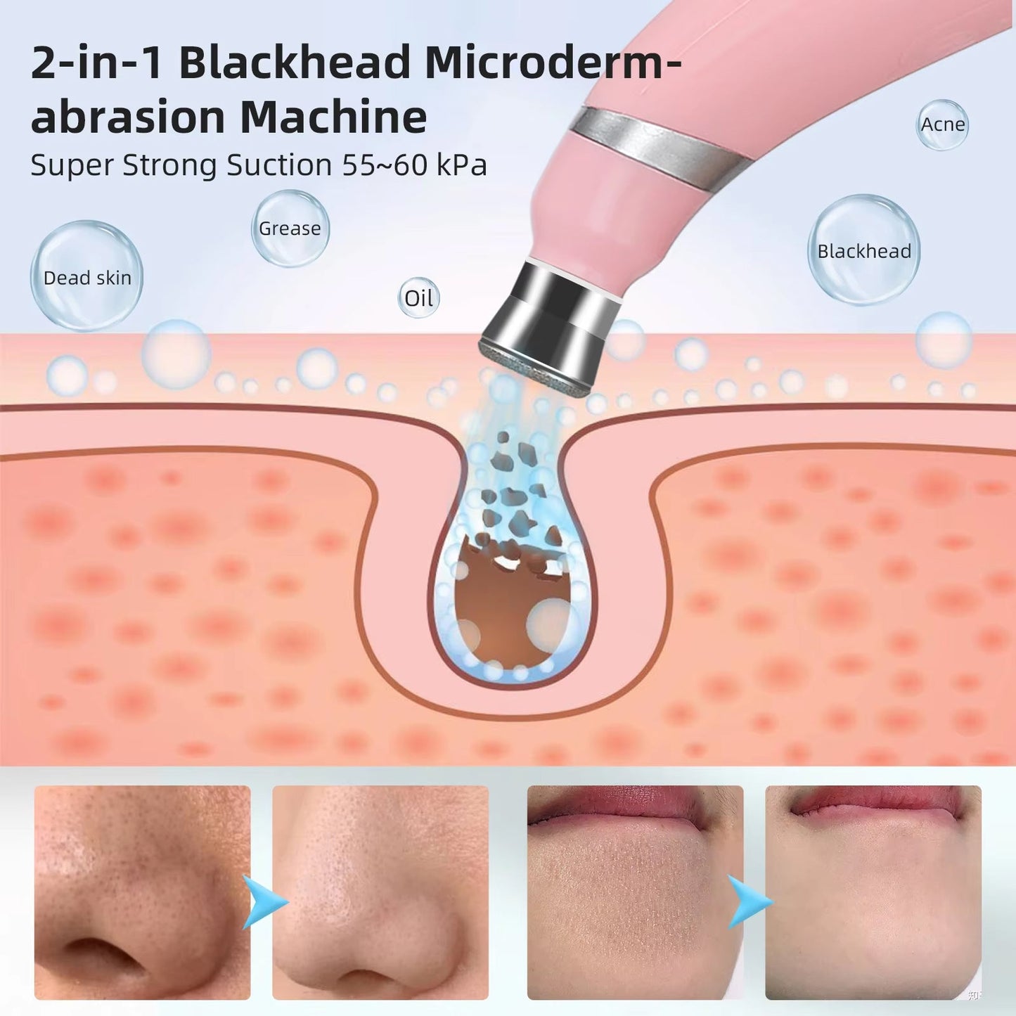 DermaaNova